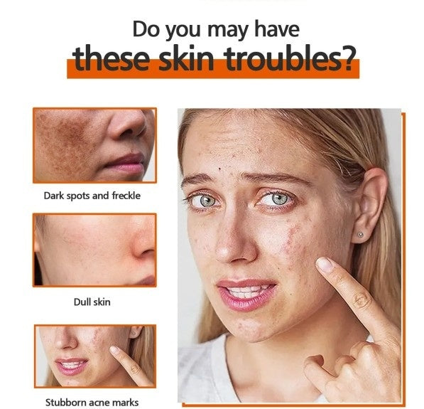 65g x 2 Kojic Acid Soap Whitening Reduce Skin Dullness Acne Treatment Anti Aging Moisturizing Hand Soap for Face Skin Care - SHOPPING YARD