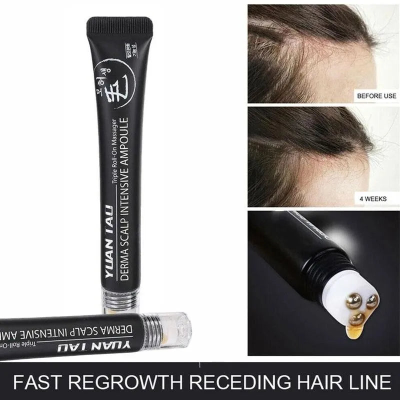 Rolling Ball Hair Growth Nourishing Hair Growth Liquid - SHOPPING YARD