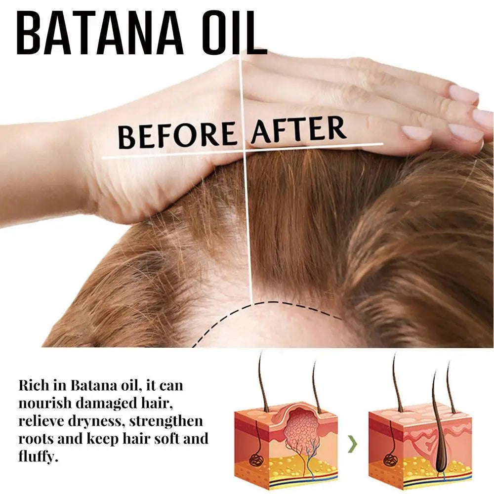 Natural Pure Batana Oil For Hair Growth Batana Oil Hair Oil Hair Loss Organic Batana Oil Hair Growth For Black Men & Women - SHOPPING YARD