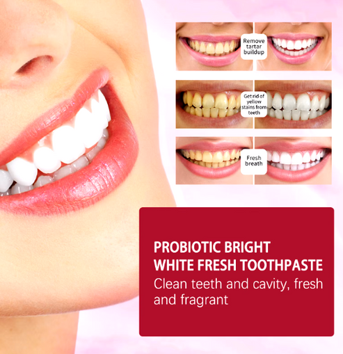 Sp4 Probiotic Whitening Toothpaste