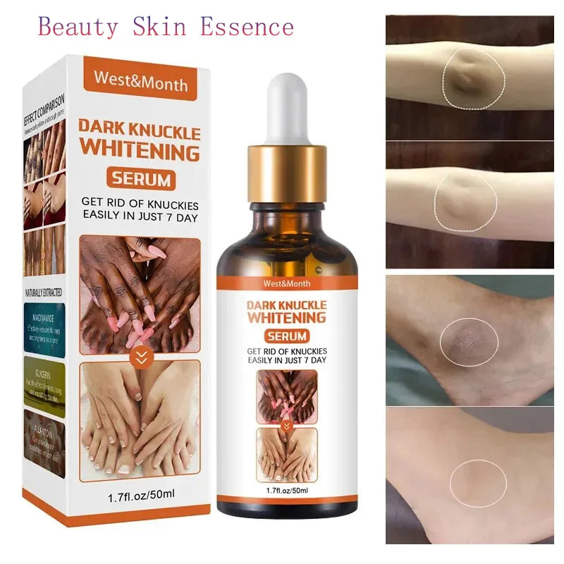 Dark Knuckles Whitening Serum Remover Get Rid of Dark Knees Dark Knuckle Elbow Cream Moisturizing Brighten Skin Tone Care - SHOPPING YARD