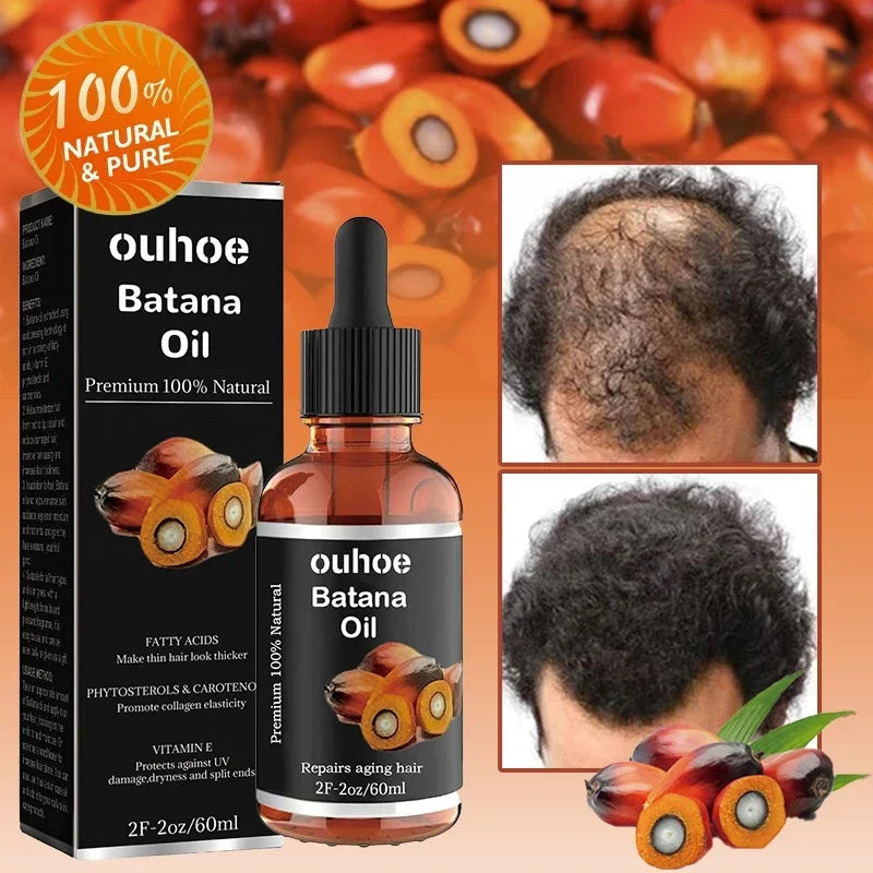 Natural Pure Batana Oil For Hair Growth Batana Oil Hair Oil Hair Loss Organic Batana Oil Hair Growth For Black Men & Women - SHOPPING YARD