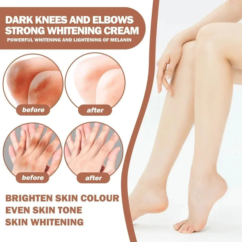 Dark Knuckles Whitening Serum Remover Get Rid of Dark Knees Dark Knuckle Elbow Cream Moisturizing Brighten Skin Tone Care - SHOPPING YARD