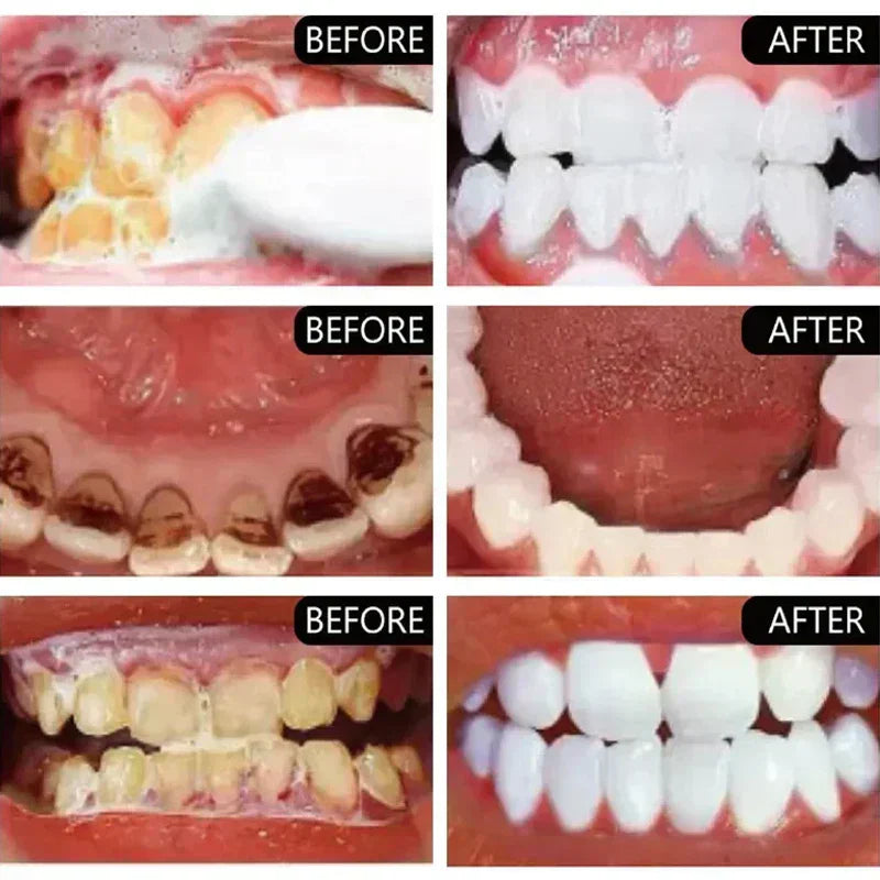 Teeth Whiten Toothpaste Fast Remove Plaque Smoke Coffee Tea Stains Clean Oral Hygiene Fresh Breath Bleaching - SHOPPING YARD