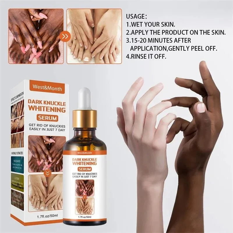 Dark Knuckles Whitening Serum Remover Get Rid of Dark Knees Dark Knuckle Elbow Cream Moisturizing Brighten Skin Tone Care - SHOPPING YARD
