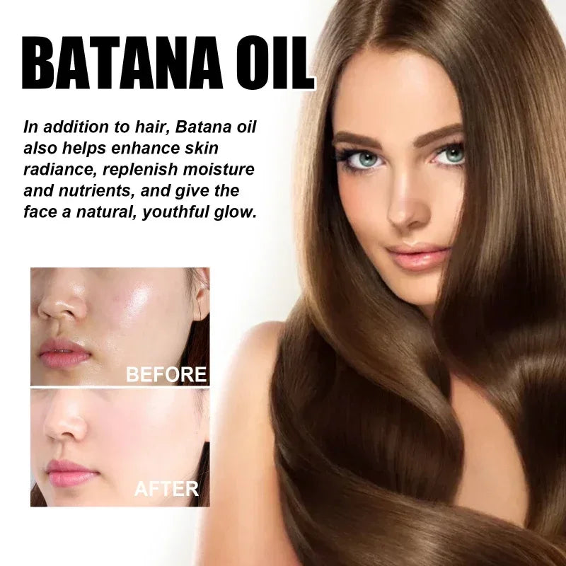 Natural Pure Batana Oil For Hair Growth Batana Oil Hair Oil Hair Loss Organic Batana Oil Hair Growth For Black Men & Women - SHOPPING YARD