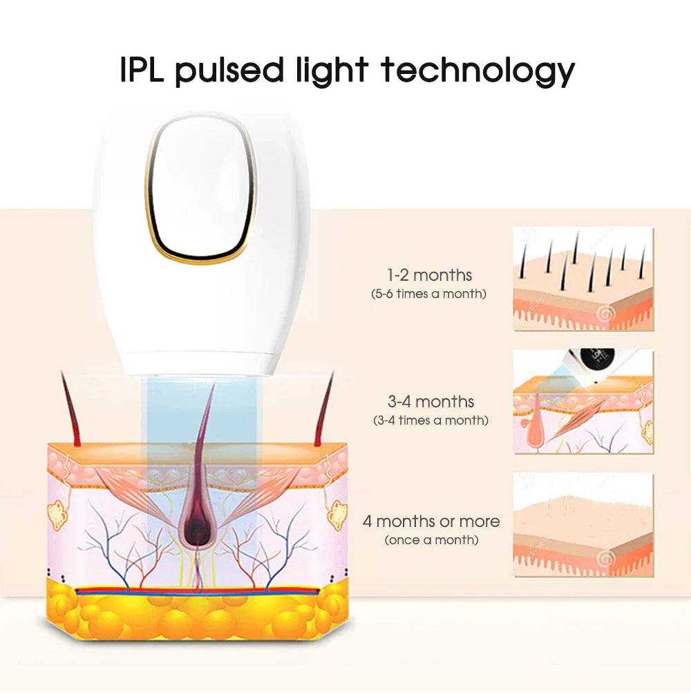 IPL Hair Removal Laser Epilator – Permanent Painless Hair Removal for Women, Portable & Efficient for Face, Body, Bikini Area - SHOPPING YARD