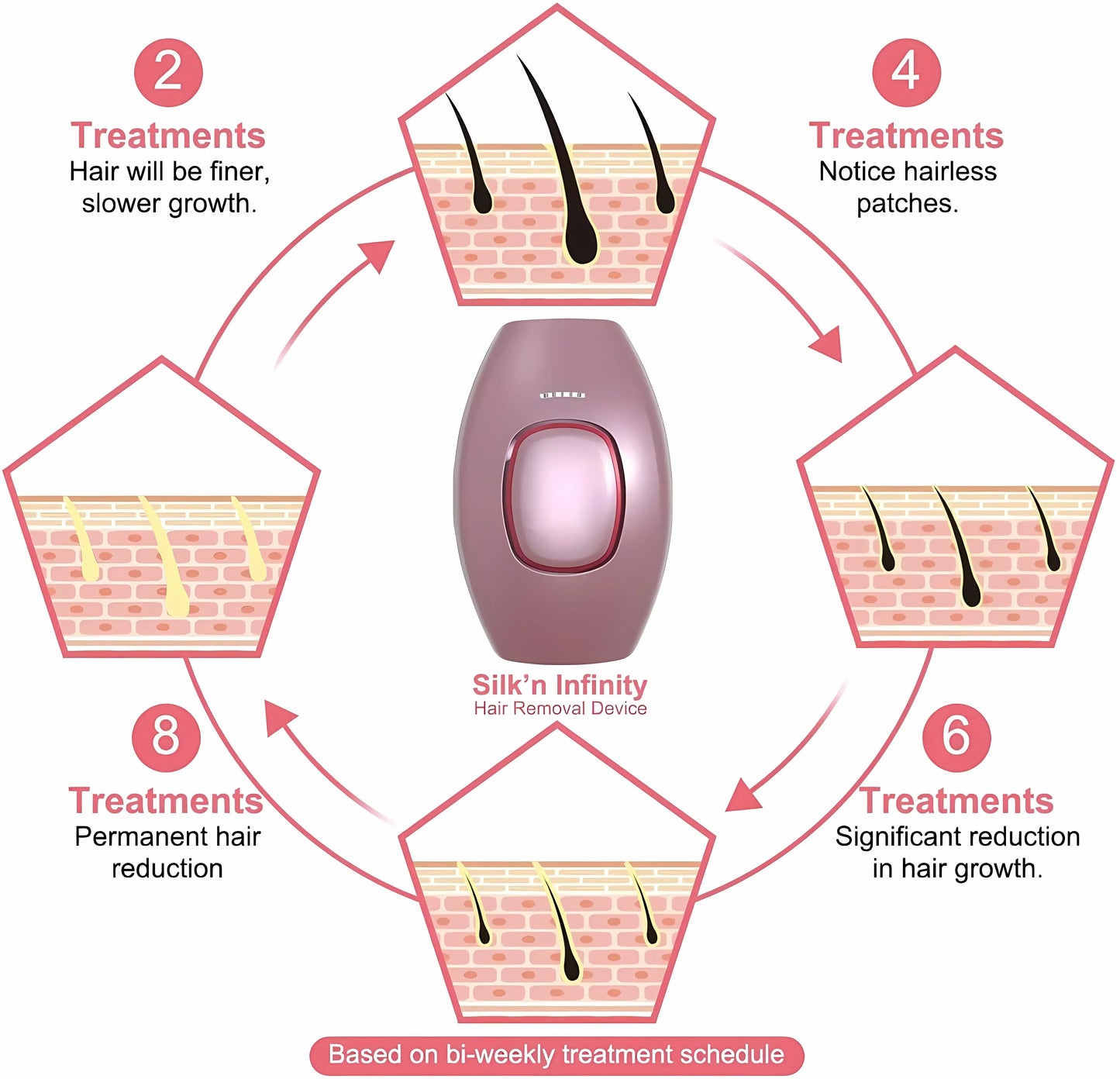 IPL Hair Removal Laser Epilator – Permanent Painless Hair Removal for Women, Portable & Efficient for Face, Body, Bikini Area - SHOPPING YARD