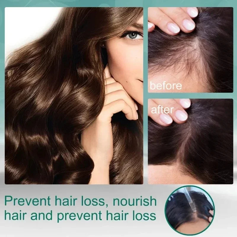 Hair Fast Growth Hair Care Essential Oil Natural Ginger Hairs Regrowth Products Serum - SHOPPING YARD