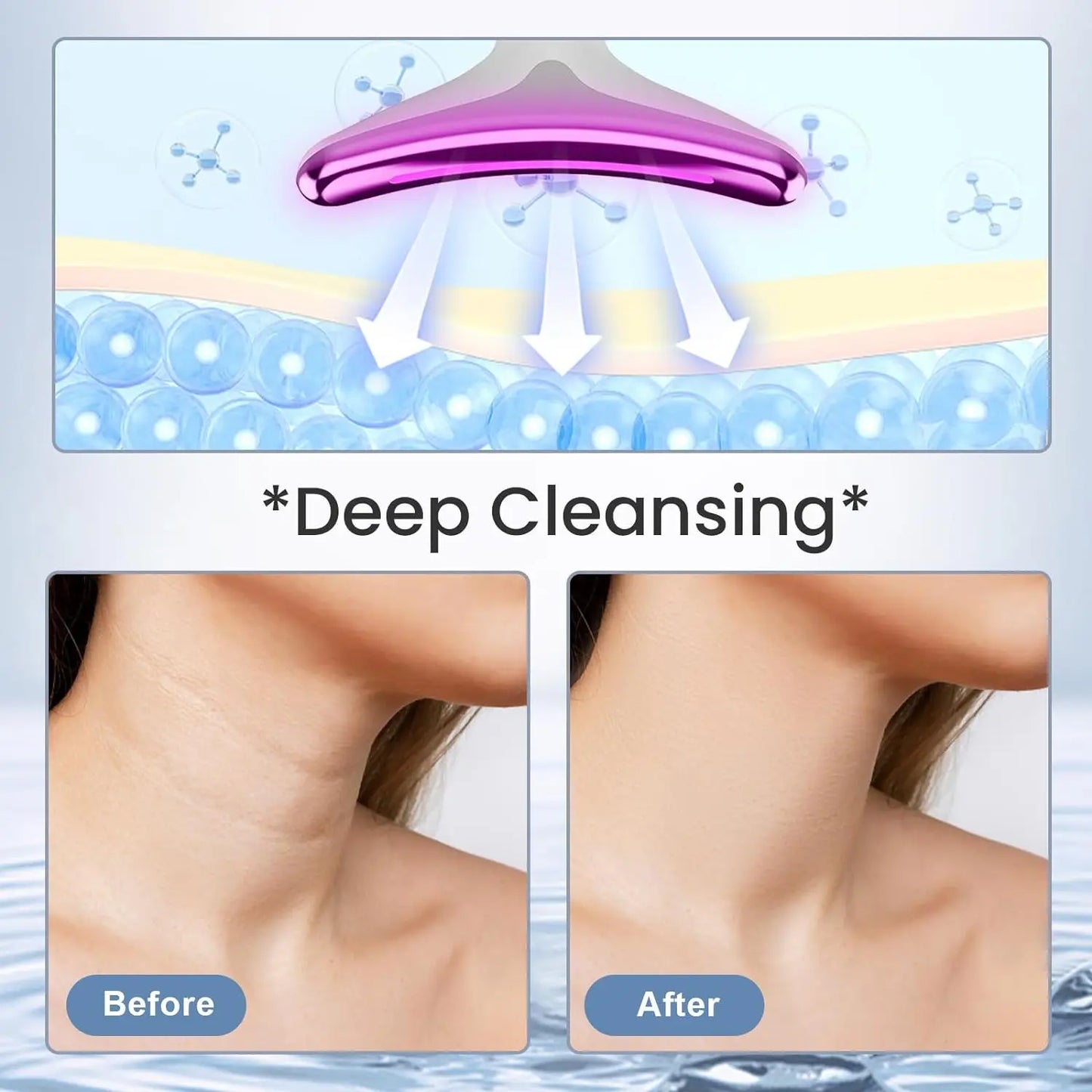 Anti Wrinkle Beauty Apparatus
