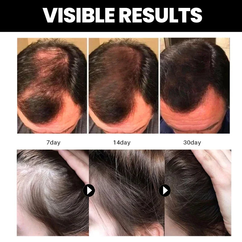Natural Pure Batana Oil For Hair Growth Batana Oil Hair Oil Hair Loss Organic Batana Oil Hair Growth For Black Men & Women - SHOPPING YARD