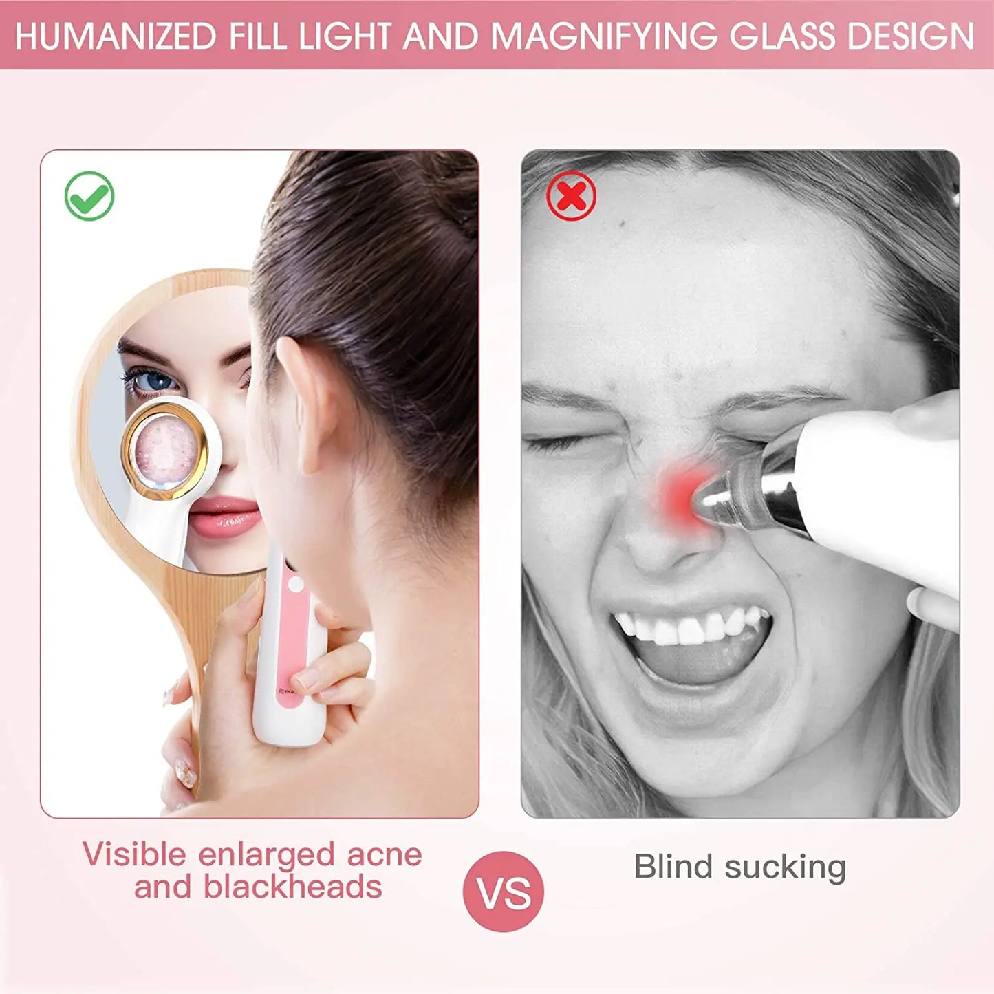 Magnifying Visible Blackhead Remover Visual Blackhead Remover Extractor Tool Set Portable Vacuum Blackhead Removal - SHOPPING YARD