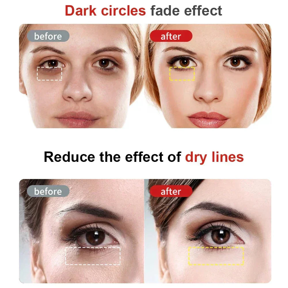 Eye Beautification Inductive Therapeutical Instrument Multi-Function RF Vibration Magic Wand Eye Beauty Massage Pen - SHOPPING YARD