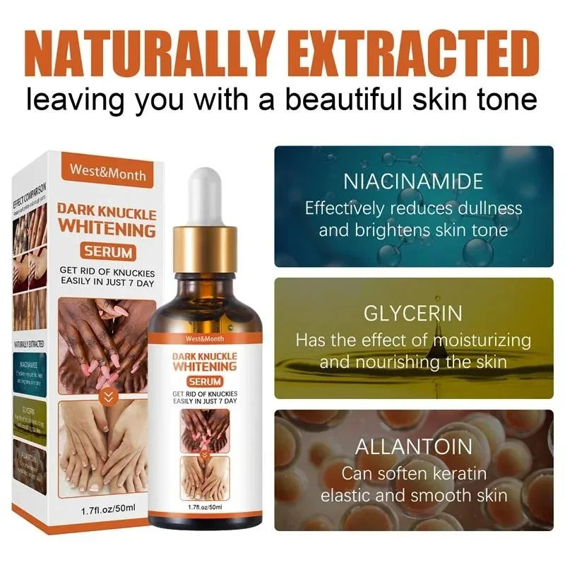 Dark Knuckles Whitening Serum Remover Get Rid of Dark Knees Dark Knuckle Elbow Cream Moisturizing Brighten Skin Tone Care - SHOPPING YARD