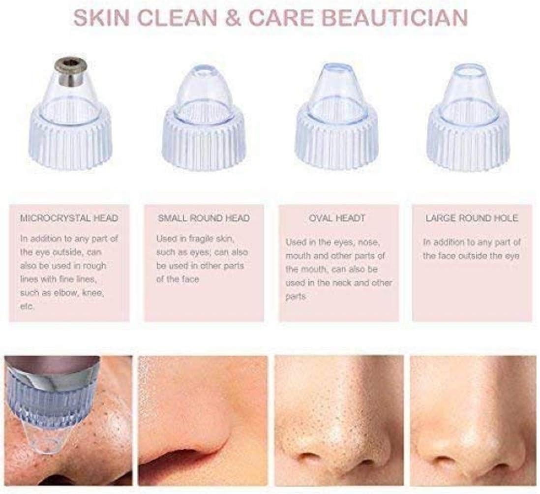 Women's Fashion Electric Blackhead Remover and Pore Cleanser for Facial Beauty and Exfoliation - SHOPPING YARD