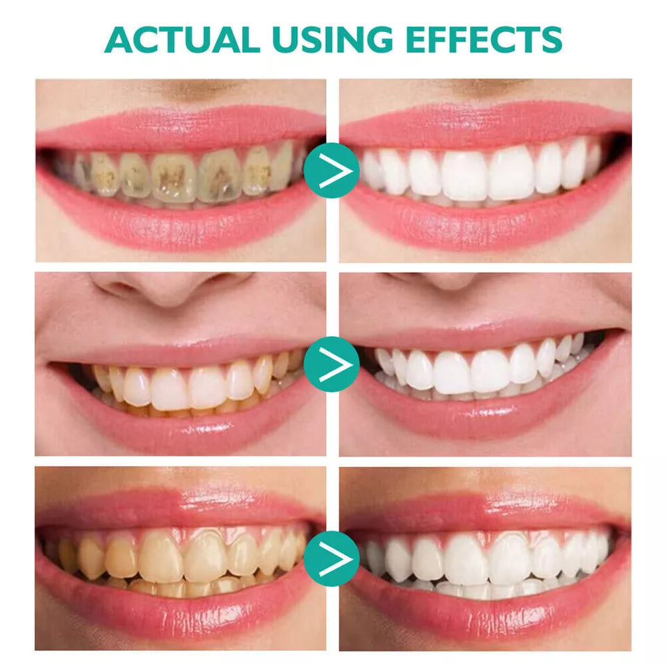 Teeth Whitening Toothpaste Foam Baking Soda Toothpaste Mousse Stains Removal - SHOPPING YARD