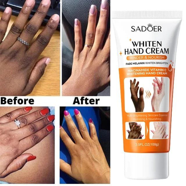 Brightening Hand Cream Dark Knuckles Fade Lightening Elbows Knee Fade Stains Improve Dry Crack Moisturizing Hand Cream - SHOPPING YARD