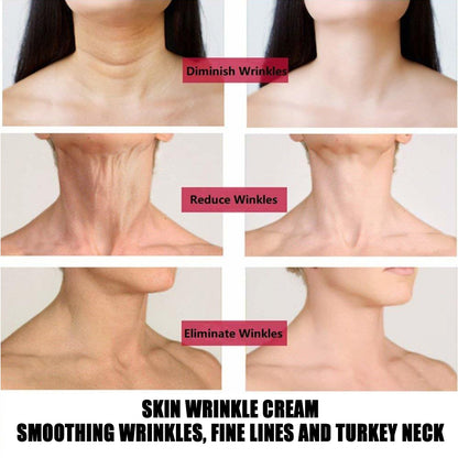 Instant Firmly Neck Face Cream Moisturizing Lifting Firming Nourishing Anti Wrinkle Whitening Cream - SHOPPING YARD