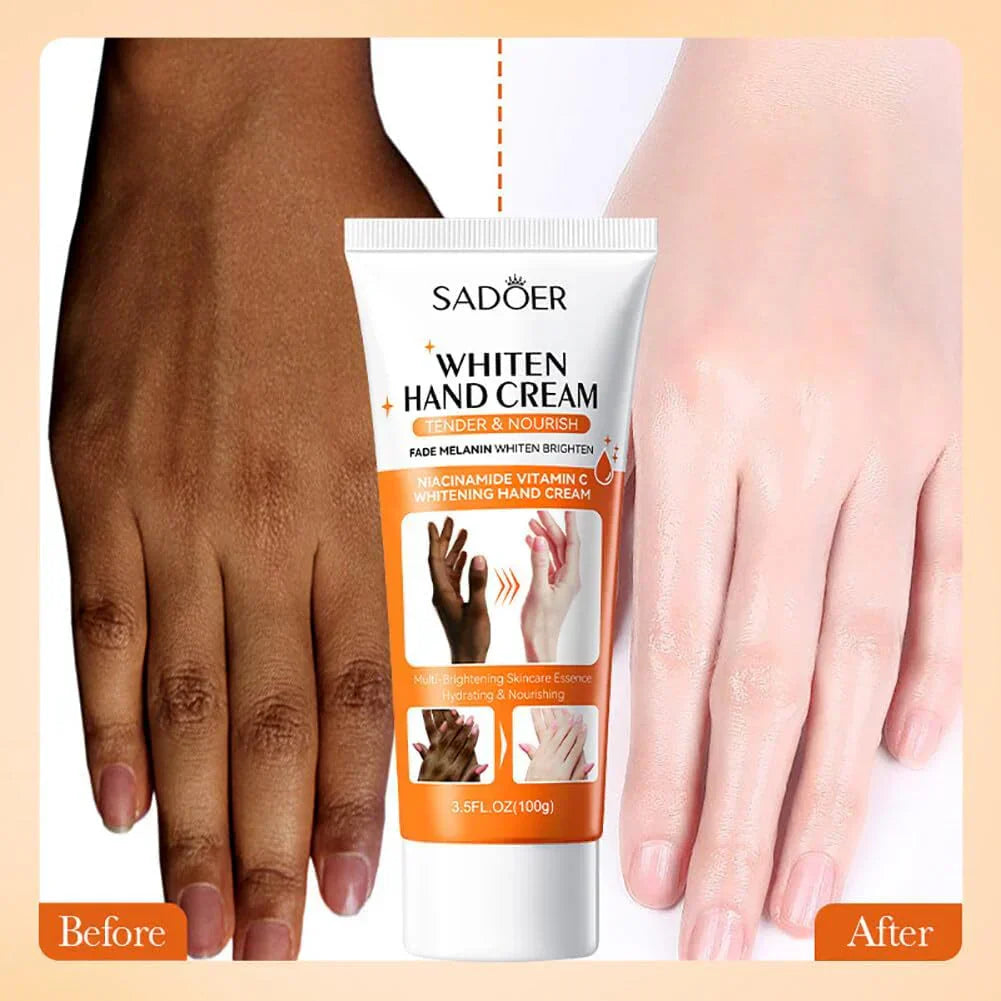Brightening Hand Cream Dark Knuckles Fade Lightening Elbows Knee Fade Stains Improve Dry Crack Moisturizing Hand Cream - SHOPPING YARD