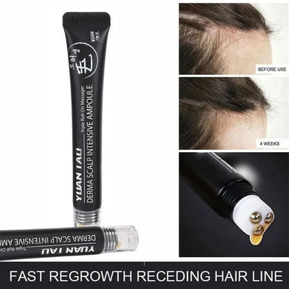 Rolling Ball Hair Growth Nourishing Hair Growth Liquid - SHOPPING YARD