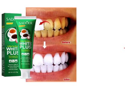 Teeth Whiten Toothpaste Fast Remove Plaque Smoke Coffee Tea Stains Clean Oral Hygiene Fresh Breath Bleaching - SHOPPING YARD