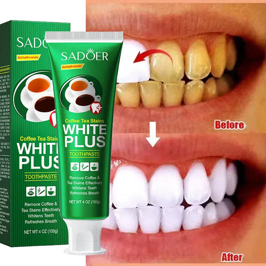 Teeth Whiten Toothpaste Fast Remove Plaque Smoke Coffee Tea Stains Clean Oral Hygiene Fresh Breath Bleaching - SHOPPING YARD