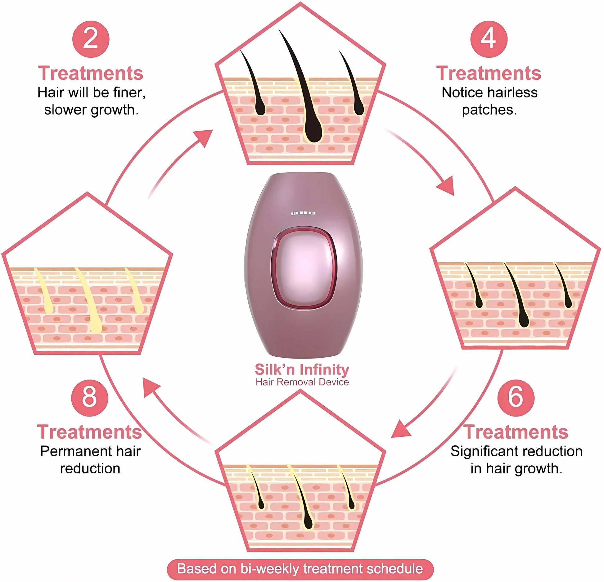 IPL Hair Removal Laser Epilator – Permanent Painless Hair Removal for Women, Portable & Efficient for Face, Body, Bikini Area - SHOPPING YARD