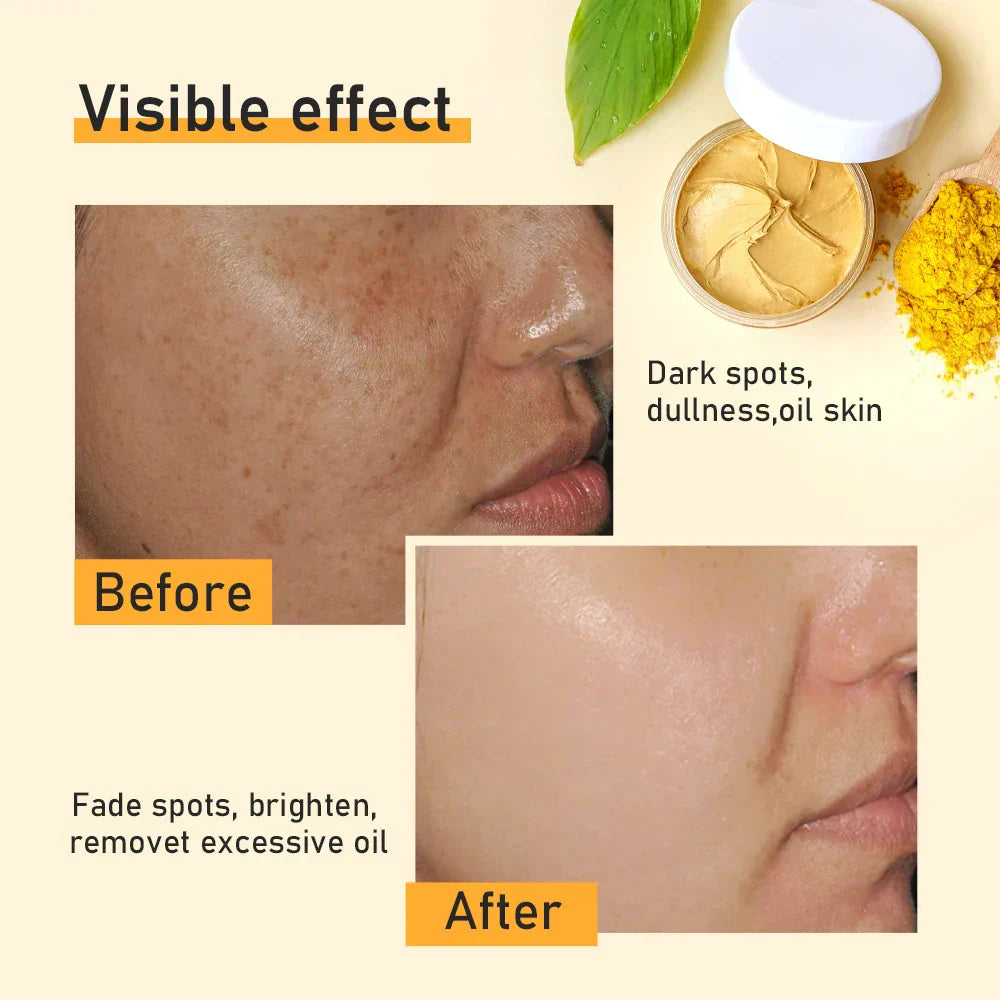 Turmeric Clay Mask Reduce Blackheads Clean Pores Soothe Acne Prone Skin Brightening Deep Cleaning Minimize Pores Skin Care 120g - SHOPPING YARD