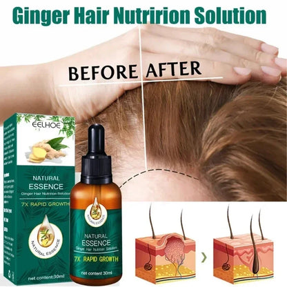 Hair Fast Growth Hair Care Essential Oil Natural Ginger Hairs Regrowth Products Serum - SHOPPING YARD