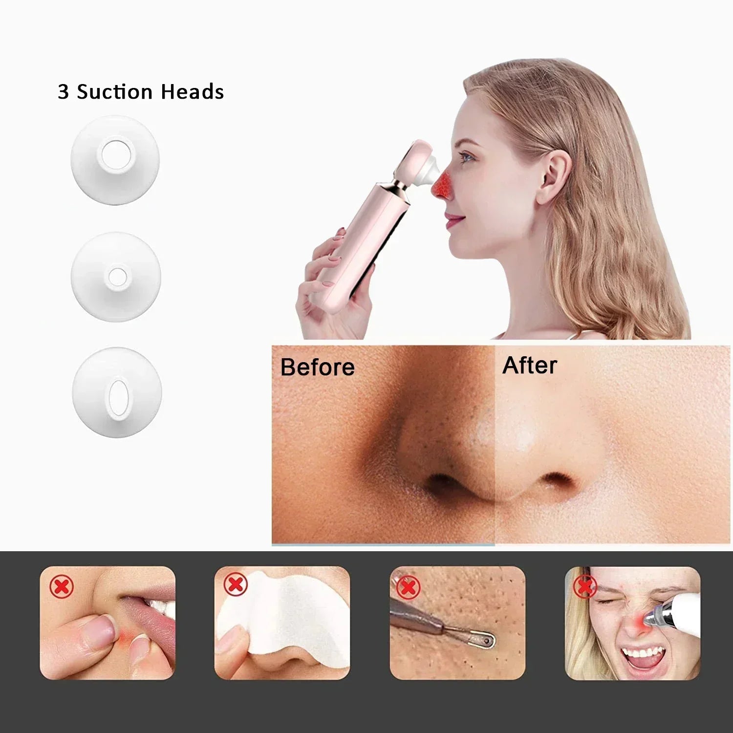 Magnifying Visible Blackhead Remover Visual Blackhead Remover Extractor Tool Set Portable Vacuum Blackhead Removal - SHOPPING YARD