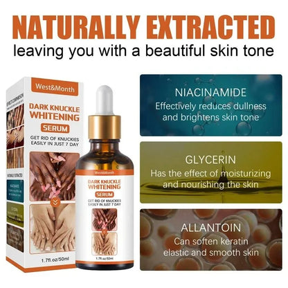 Dark Knuckles Whitening Serum Remover Get Rid of Dark Knees Dark Knuckle Elbow Cream Moisturizing Brighten Skin Tone Care - SHOPPING YARD