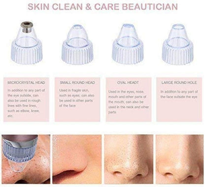 Women's Fashion Electric Blackhead Remover and Pore Cleanser for Facial Beauty and Exfoliation - SHOPPING YARD