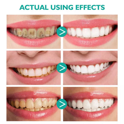 Teeth Whitening Toothpaste Foam Baking Soda Toothpaste Mousse Stains Removal - SHOPPING YARD
